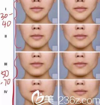 不同情况注射瘦脸除皱需要的单位图