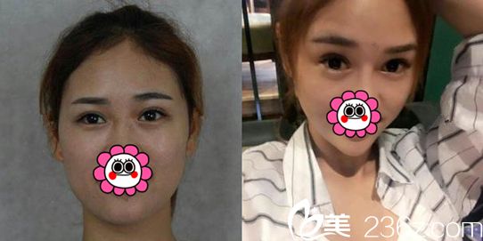 陈璋<span style= 陈璋<span style=