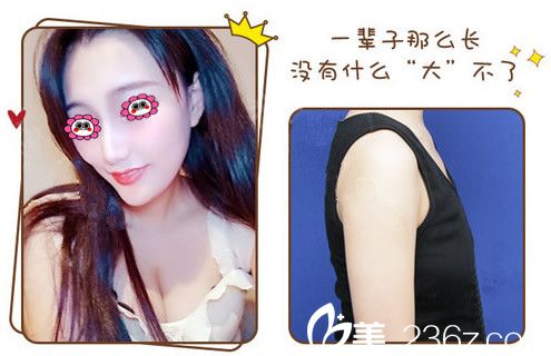 嘉兴曙光整形高俊隆胸变化图 嘉兴曙光整形高俊隆胸变化图