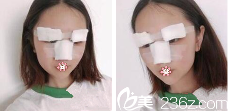 我做手术当天 我做手术当天