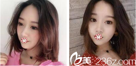 泰国然禧Yanhee整形医院怎么样 泰国然禧Yanhee整形医院怎么样