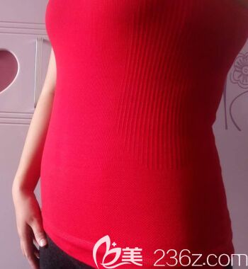 我在太原欧美莲做360水动力腰腹部吸脂第10天