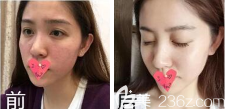 贵阳美贝尔案例 贵阳美贝尔案例