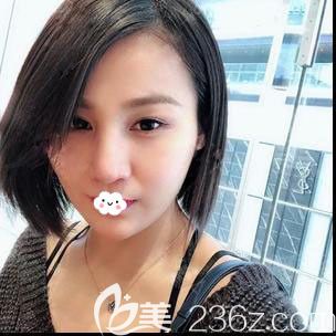 <!--<i data=20240703-sp></i>-->时光隆鼻效果怎么样？包涛鼻综合修复案例