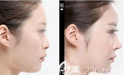 吴礼诚<span style= 吴礼诚<span style=