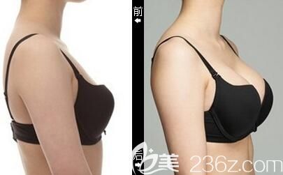 殷运成<span style= 殷运成<span style=