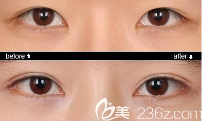 熊学俊<span style= 熊学俊<span style=