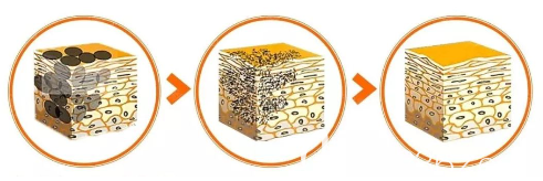 激光祛斑过程 激光祛斑过程