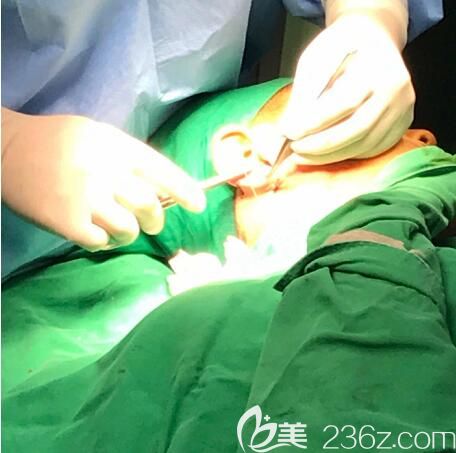 韩国Profile整形外科&牙科医院郑在皓耳矫正真人案例手术矫正中