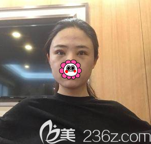 在北京画美做双眼皮修复第4天<span style= 在北京画美做双眼皮修复第4天<span style=