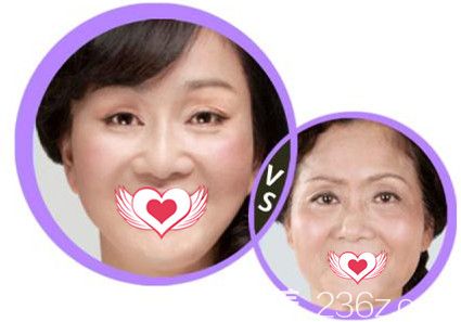 邯郸维多利亚2019新年整形优惠活动火热进行中 全部项目打5折双眼皮仅580元