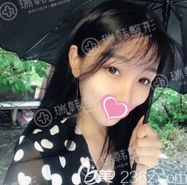 术后20天恢复效果 术后20天恢复效果