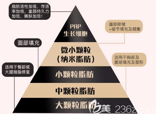 北京当代自体脂肪金字塔式移植形态示意图