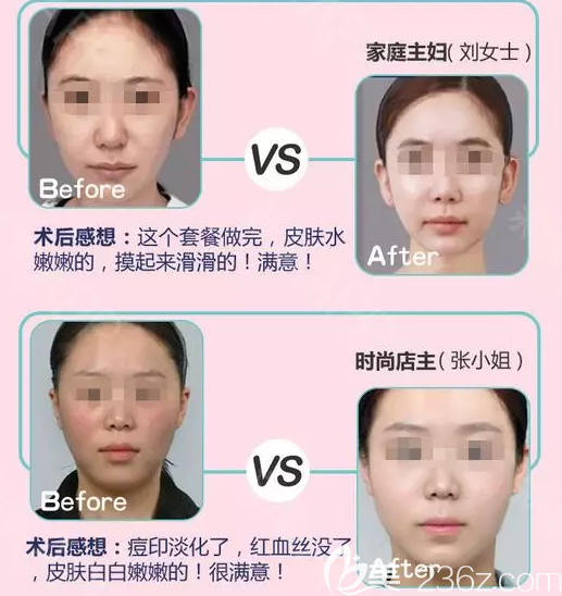 岳阳你美少女针真人案例