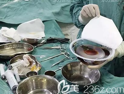 南宁东方整形赵波院长给我做隆胸前选假体照片