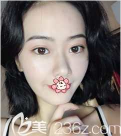 刘彦龙医生给我手术后半个月 刘彦龙医生给我手术后半个月