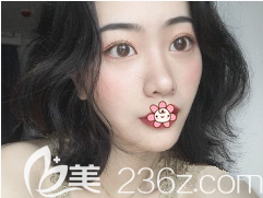 重庆艺星整形做双眼皮怎么样 重庆艺星整形做双眼皮怎么样