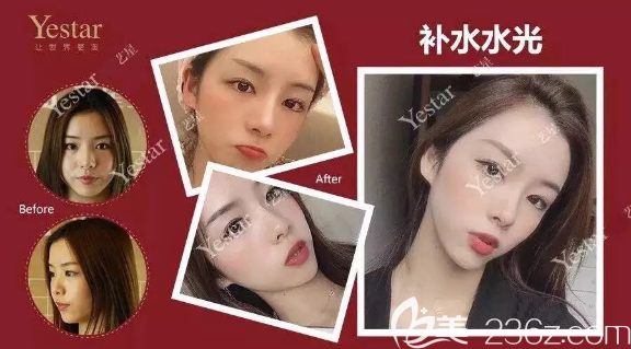 重庆艺星整形案例 重庆艺星整形案例