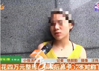 欧女士女士接受记者采访时候的鼻部状况