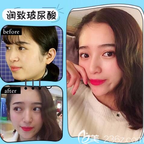 合肥韩美医院怎么样,好不好?真人案例+评价来验证 合肥韩美医院怎么样,好不好?真人案例+评价来验证