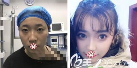 重庆艺星整形哪位医生做双眼皮比较好