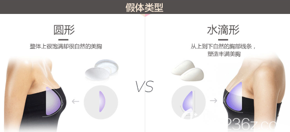 假体类型 假体类型