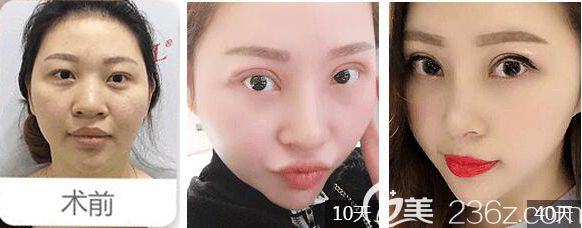 常州美贝尔眼鼻综合恢复<span style= 常州美贝尔眼鼻综合恢复<span style=