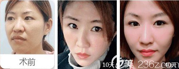 常州美贝尔面部年轻化 常州美贝尔面部年轻化