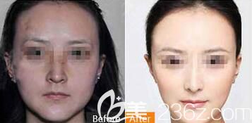 无锡施尔美水光焕颜 无锡施尔美水光焕颜