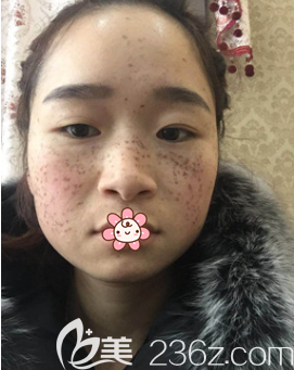 赵蓉医生给我手术当天 赵蓉医生给我手术当天