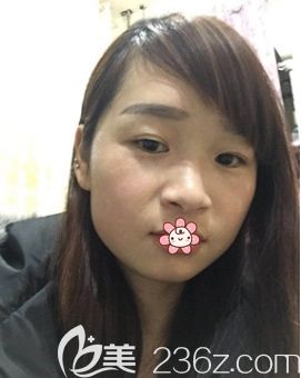 重庆艺星整形祛斑怎么样 重庆艺星整形祛斑怎么样