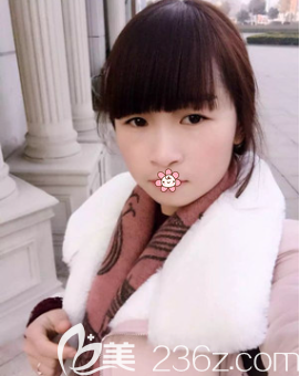 赵蓉激光祛雀斑术后3个月 赵蓉激光祛雀斑术后3个月