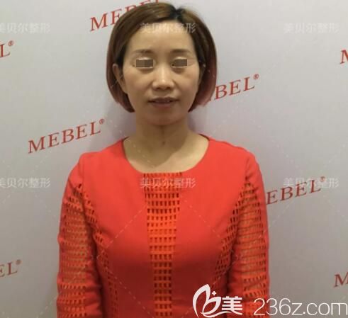 到苏州美贝尔面诊术前面部凹陷显老 到苏州美贝尔面诊术前面部凹陷显老