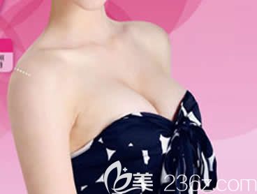 反馈:我在柳州华美整形做曼托水滴形假体隆胸术后1个月胸部变软手感自然
