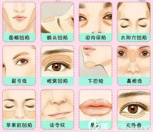 面部衰老迹象 面部衰老迹象