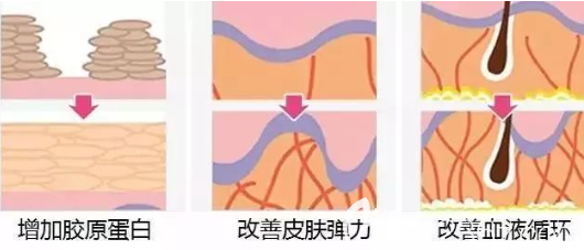 贵阳华美线雕效果持久 贵阳华美线雕效果持久