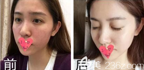 贵阳美贝尔多少钱 贵阳美贝尔多少钱