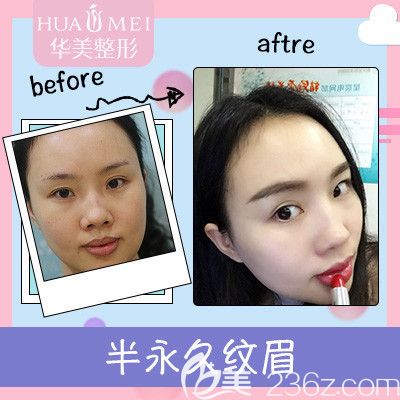 汕头华美半纹眉案例对比图