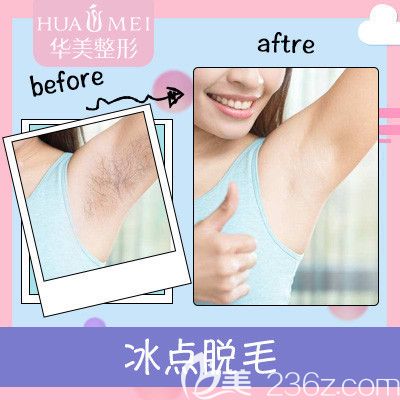 汕头华美冰点脱毛案例