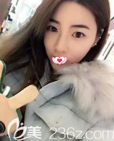 <!--<i data=20240703-sp></i>-->医生做鼻综合10天后鼻子消肿 <!--<i data=20240703-sp></i>-->医生做鼻综合10天后鼻子消肿