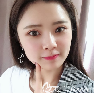 看汕头华美田学勤做的双眼皮好不好看