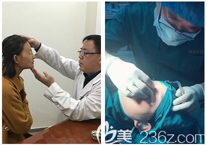 南京美贝尔医生面诊设计面部吸脂手术方案