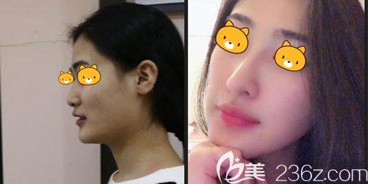 罗志敏<span style= 罗志敏<span style=