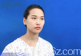 手术当天我的面部状态