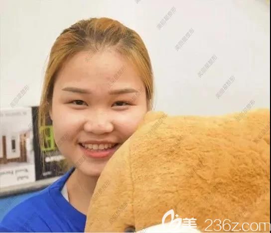 我在南宁美丽星整形做眼鼻部综合整形前的照片 我在南宁美丽星整形做眼鼻部综合整形前的照片