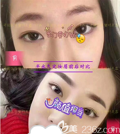 攀枝花奇丽半纹眉术前后对比效果