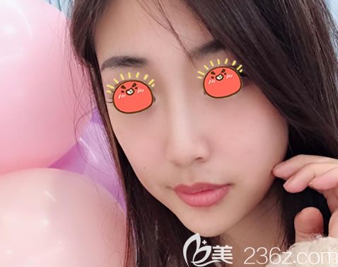 宁波薇琳<!--<i data=20240703-sp></i>-->假体隆鼻<span style= 宁波薇琳<!--<i data=20240703-sp></i>-->假体隆鼻<span style=