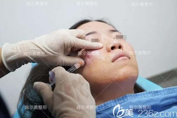 江苏施尔美医生面部注射玻尿酸丰苹果肌 江苏施尔美医生面部注射玻尿酸丰苹果肌