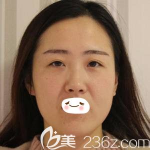 郑州华领全面部PPDO<span style= 郑州华领全面部PPDO<span style=