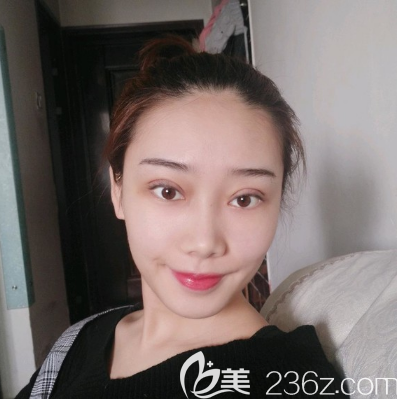 汕头华美做双眼皮怎么样